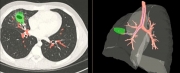 advanced-diagnostic-center-CT-scan-figure3a