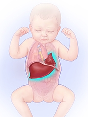 Illustration of liver and bowel herniated into fetal chest