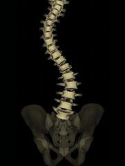 3D Imaging of the Spine