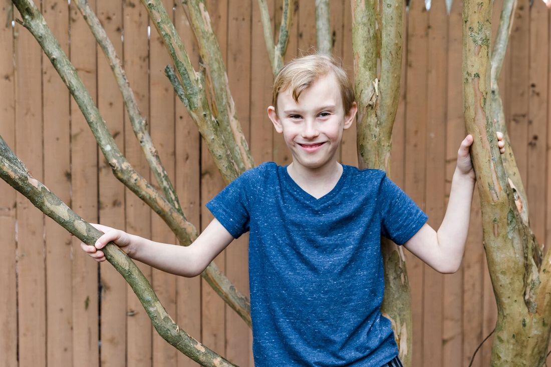 Blonde Boy patient who had plastic surgery standing in front of fence.