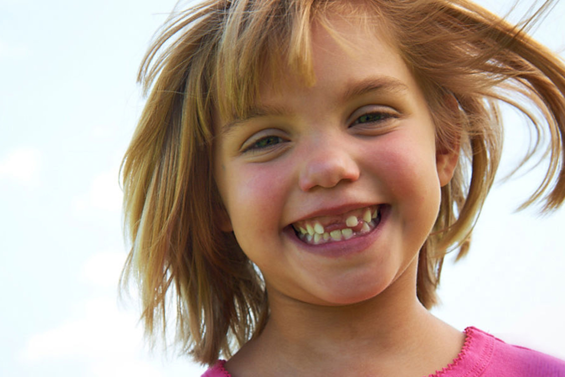 Little girl missing front teeth smiling big at the camera.