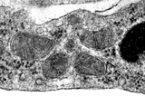 An image taken through scanning electron microscopy shows healthy mitochondria in brain endothelial cells from 22qDS animals treated with bezafibrate