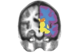 right brain image right brain image
