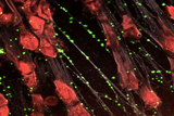 new sepsis treatment imaging new sepsis treatment imaging