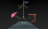 type 1 lymphatic perfusion leading to plastic bronchitis