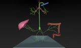 Type 2 pulmonary lymphatic perfusion leading to plastic bronchitis 