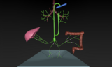 Type 3 pulmonary lymphatic perfusion leading to plastic bronchitis 