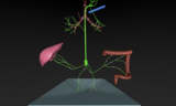 Type 4 pulmonary lymphatic perfusion leading to plastic bronchitis