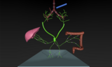 Type 5 pulmonary lymphatic perfusion leading to plastic bronchitis