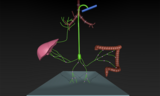 Type 6 pulmonary lymphatic perfusion leading to plastic bronchitis