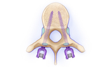 To shorten the spinal column, screws are placed into a few of the spinal bones (vertebral bodies). The screws travel from the back of the spinal bones, through an area called the pedicle, into the front of the spinal bones.