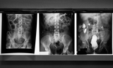 Pioneering radiologists at CHOP establish pediatric radiology as a distinct discipline.