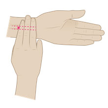 Acupressure - What are acupressure bands?