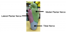 Bottom of foot chart