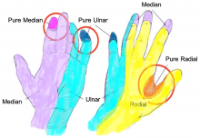 Sensory exam hand chart