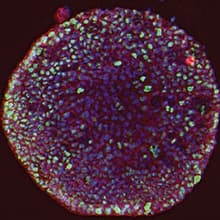 Colon organoid image