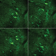 Fluorescent images of neuronal activity