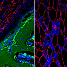 Left is a histology of the heterotopic ossification; right is a histology of the treated model limb, showing no heterotopic ossification.