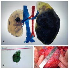 Tumor collage