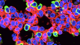 CRISPR-edited lung cells