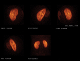 DSMA Scan Image