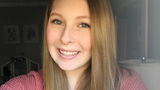 Alexa hyperhidrosis patient smiling