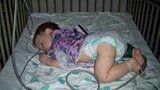 Miles as a baby after treatment at CHOP