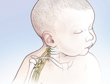 What is Brachial Plexus Image