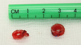 complete tracheal rings