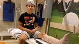 Compound Fracture: Anthony’s Story
