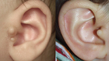 Ear Tags Image