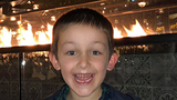 Will smiling Spina bifida fetal surgery patient Will, smiling