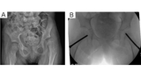 Figure 1: A & B