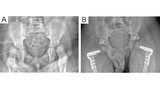 Figure 2: A & B
