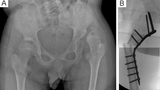 Figure 3: A & B