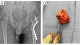 Figure 3: C & D