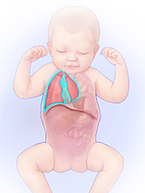 When abdominal organs move into the chest, they can crowd the heart and lungs, and keep the lungs (highlighted) from growing normally.