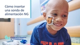 Cómo insertar una sonda nasogástrica (NG)