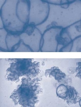 Promising Use for Antibody Treatment for EoE - Slides of patient-derived organoids
