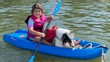 Saethre-Chotzen Syndrome and Encephalocele: Elana’s Story - Kayak