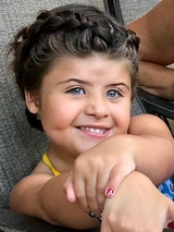 Saethre-Chotzen Syndrome and Encephalocele: Elana’s Story - Smiling