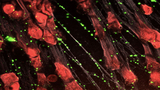 new sepsis treatment imaging new sepsis treatment imaging
