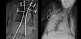 Figures 6 and 7