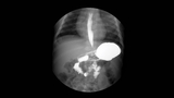 Upper GI Image