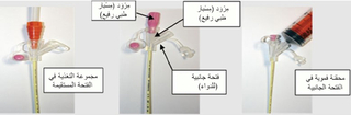 Preparing for NG tube placement - Arabic