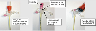 Marcador o bolígrafo indeleble