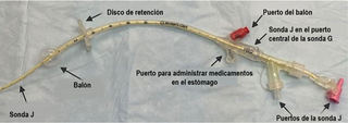 Long, Floppy Balloon Gastro-Jejunostomy tubes (GJ tubes) - Spanish