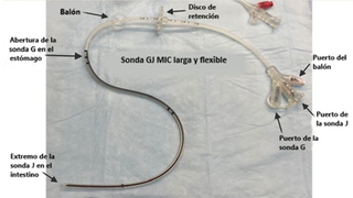 Long, Floppy Balloon Gastro-Jejunostomy tubes (GJ tubes) - Spanish
