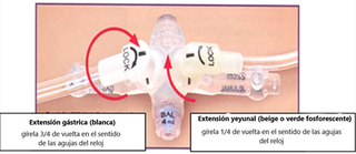 Low-Profile Balloon Gastro-Jejunostomy Tubes (GJ tubes) - Spanish