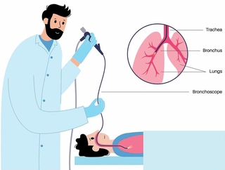 PUL_Bronschoscopy-2